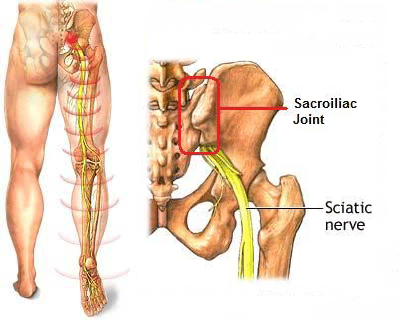 si-joint-pain